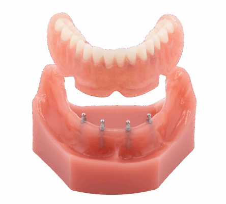 Dentures in Idaho Falls, ID | Schedule a Free Consultation Today