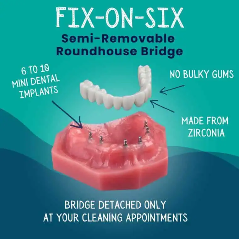 Fix-on-Six-In-Idaho-Falls-ID