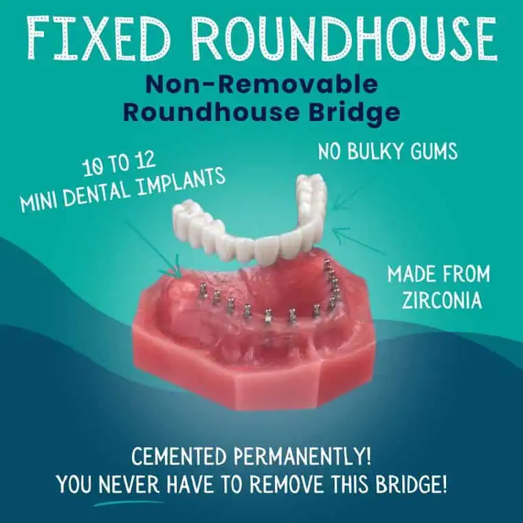 Fixed-Roundhouse-Bridge-in-Idaho-Falls-ID