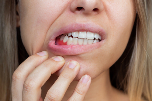 Gum Disease Treatment in Idaho Falls, ID | Free Consultations