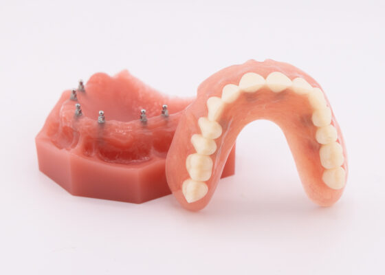 Mini Implant Dentures Implant Dentures in Idaho Falls, ID