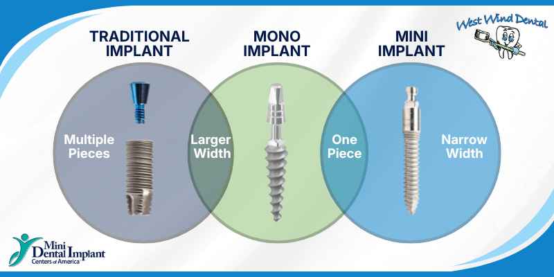 Traditional Dental Implants vs. Mono Dental Implants vs. Mini Dental Implants