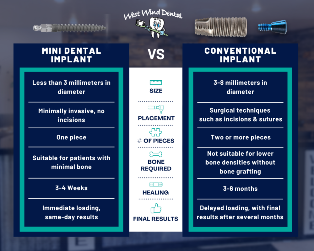 Types-of-Dental-Implants-in-Idaho-Falls-Book-a-FREE-Consultation