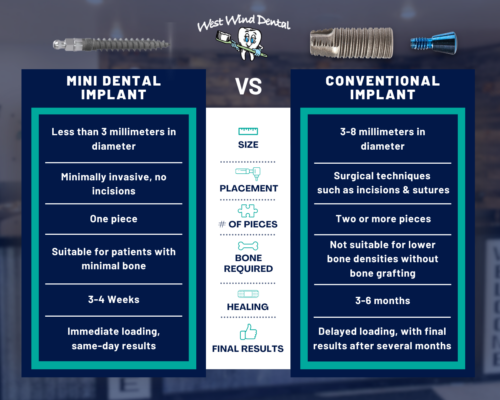 Types-of-Dental-Implants-in-Idaho-Falls-Book-a-FREE-Consultation