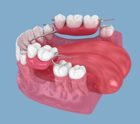 Partial Dentures in Rigby, Idaho Book a FREE Consultation2