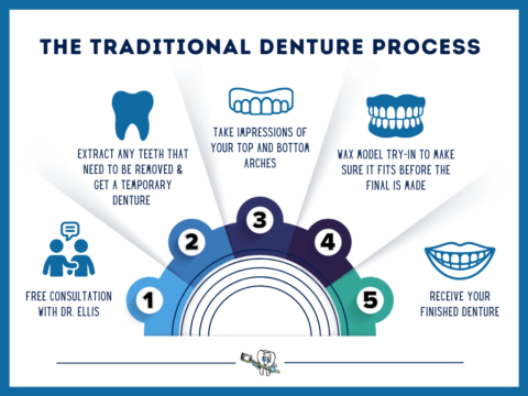 Full Dentures in Idaho Falls Schedule a FREE Consultation Today