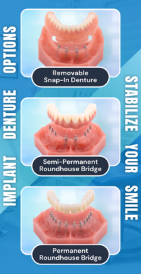 Mini Dentures in Rigby, Idaho Affordable Dental Implant Dentures